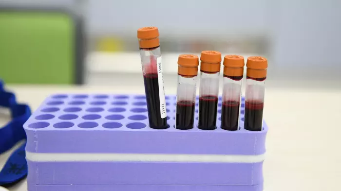 Khosla, VCs plow US$100m into blood test startup using AI