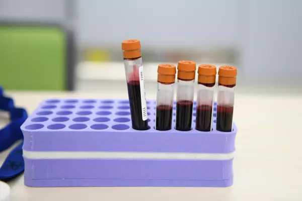 Khosla, VCs plow US$100m into blood test startup using AI