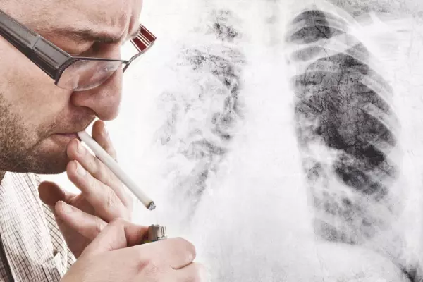 Lung cancer was once a death sentence. Now that's changing