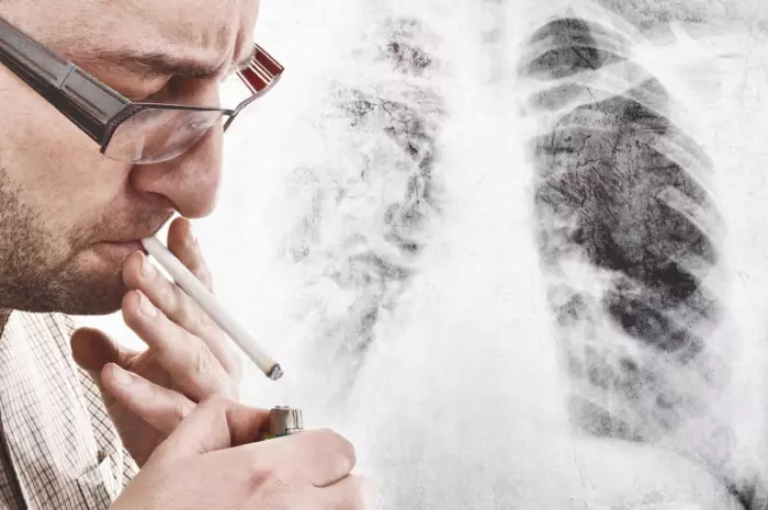 Lung cancer was once a death sentence. Now drugs are saving lives
