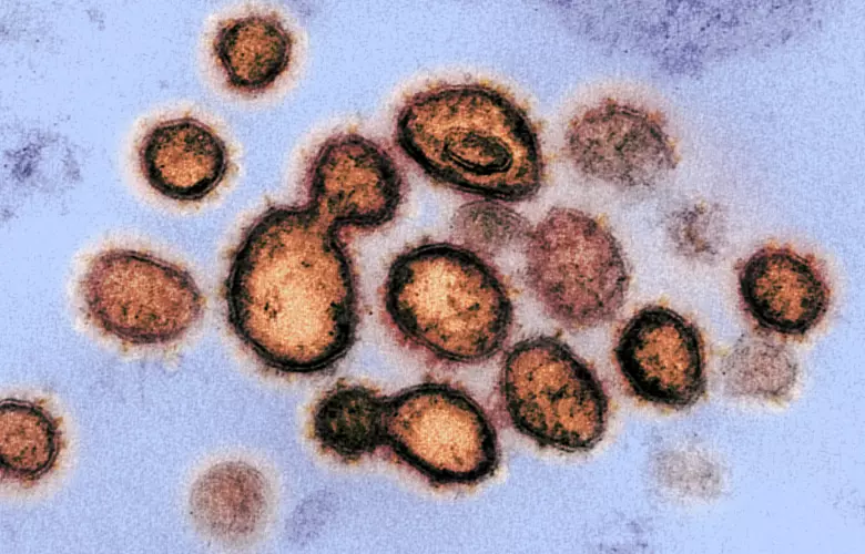 The virus leaves "long-haulers" at greater risk of dying than others who get over it quickly. (Image: NIAID)